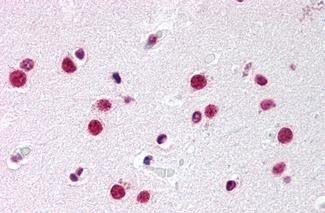 NR5A1 Antibody in Immunohistochemistry (Paraffin) (IHC (P))