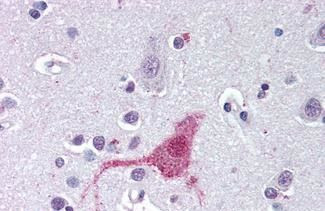 Endothelin B Receptor Antibody in Immunohistochemistry (Paraffin) (IHC (P))