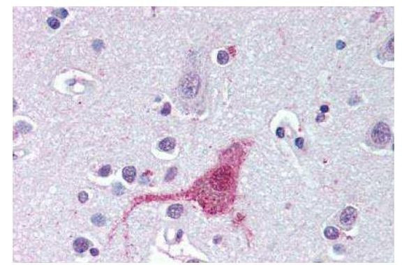 Endothelin B Receptor Antibody in Immunohistochemistry (Paraffin) (IHC (P))