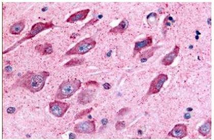 TAOK1 Antibody in Immunohistochemistry (Paraffin) (IHC (P))