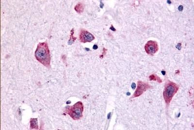 TAOK1 Antibody in Immunohistochemistry (Paraffin) (IHC (P))