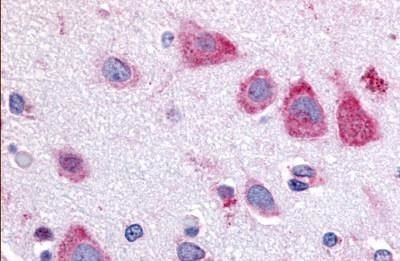 TAOK1 Antibody in Immunohistochemistry (Paraffin) (IHC (P))