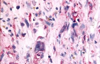 TAOK1 Antibody in Immunohistochemistry (Paraffin) (IHC (P))