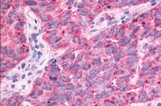 TAOK1 Antibody in Immunohistochemistry (Paraffin) (IHC (P))