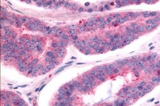 TAOK1 Antibody in Immunohistochemistry (Paraffin) (IHC (P))