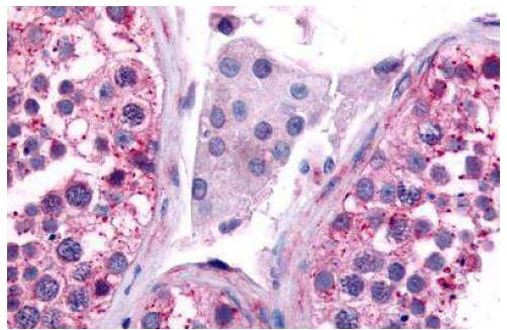 Cdc7 Antibody in Immunohistochemistry (Paraffin) (IHC (P))