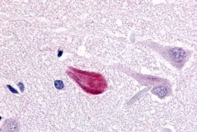 Cdc7 Antibody in Immunohistochemistry (Paraffin) (IHC (P))