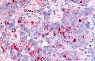 Cdc7 Antibody in Immunohistochemistry (Paraffin) (IHC (P))