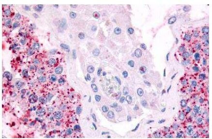 Cdc7 Antibody in Immunohistochemistry (Paraffin) (IHC (P))