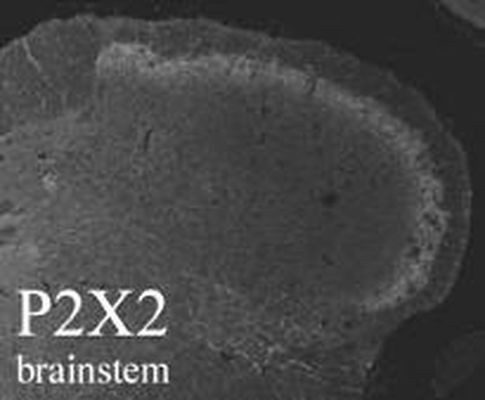 P2X2 Antibody in Immunohistochemistry (Frozen) (IHC (F))