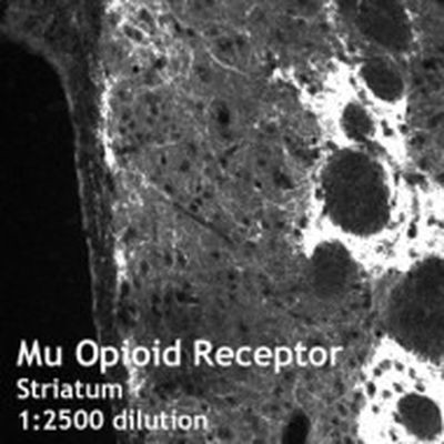 OPRM1 Antibody in Immunohistochemistry (Frozen) (IHC (F))