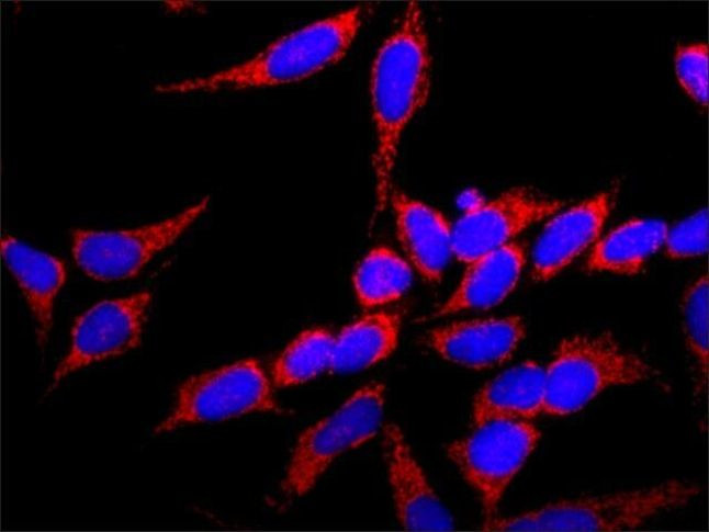 FGFR1 Antibody in Immunocytochemistry (ICC/IF)