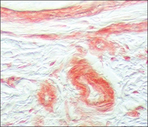 FGFR1 Antibody in Immunohistochemistry (Paraffin) (IHC (P))