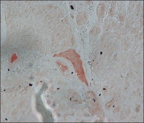 FGFR2 Antibody in Immunohistochemistry (Paraffin) (IHC (P))