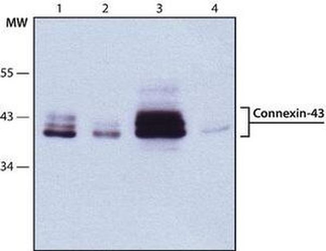 Connexin 43 Antibody in Western Blot (WB)