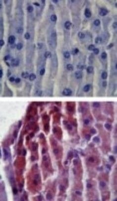 TLR2 Antibody in Immunohistochemistry (Paraffin) (IHC (P))