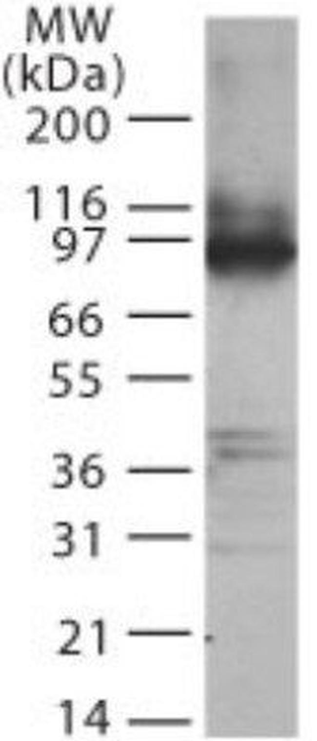 TLR2 Antibody in Western Blot (WB)