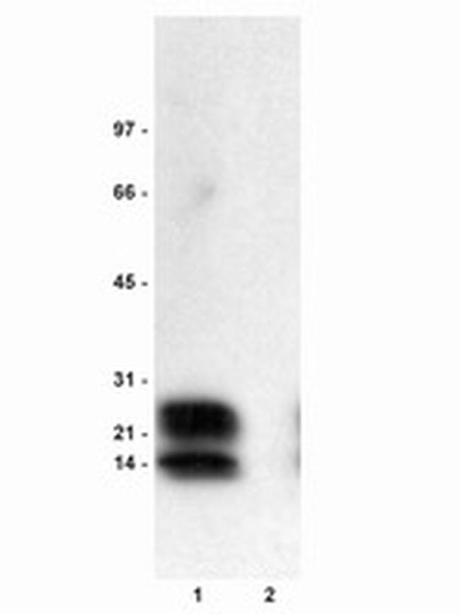Phospho-Phospholamban (Ser16) Antibody in Western Blot (WB)
