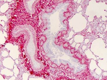 Collagen I Antibody in Immunohistochemistry (Paraffin) (IHC (P))