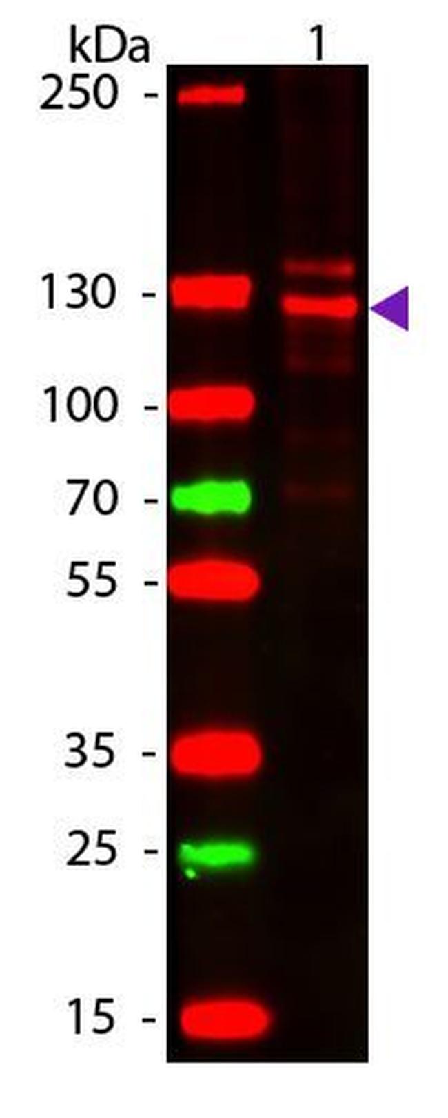 Collagen I Antibody in Western Blot (WB)