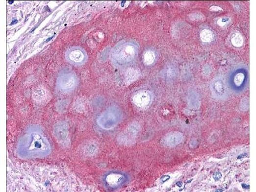 Collagen II Antibody in Immunohistochemistry (Paraffin) (IHC (P))