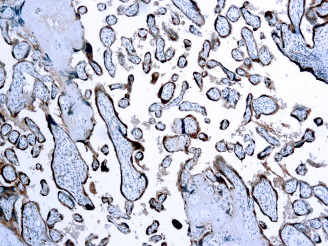 hCG beta Antibody in Immunohistochemistry (Paraffin) (IHC (P))