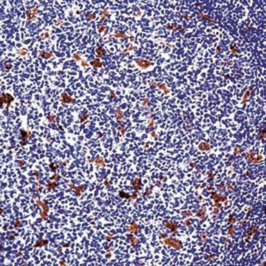 Lysozyme Antibody in Immunohistochemistry (Paraffin) (IHC (P))