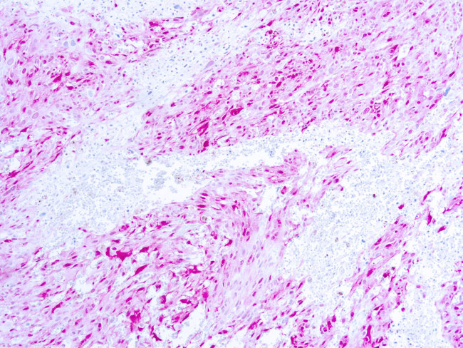 S100 Antibody in Immunohistochemistry (Paraffin) (IHC (P))