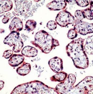 Caspase 1 Antibody in Immunohistochemistry (IHC)