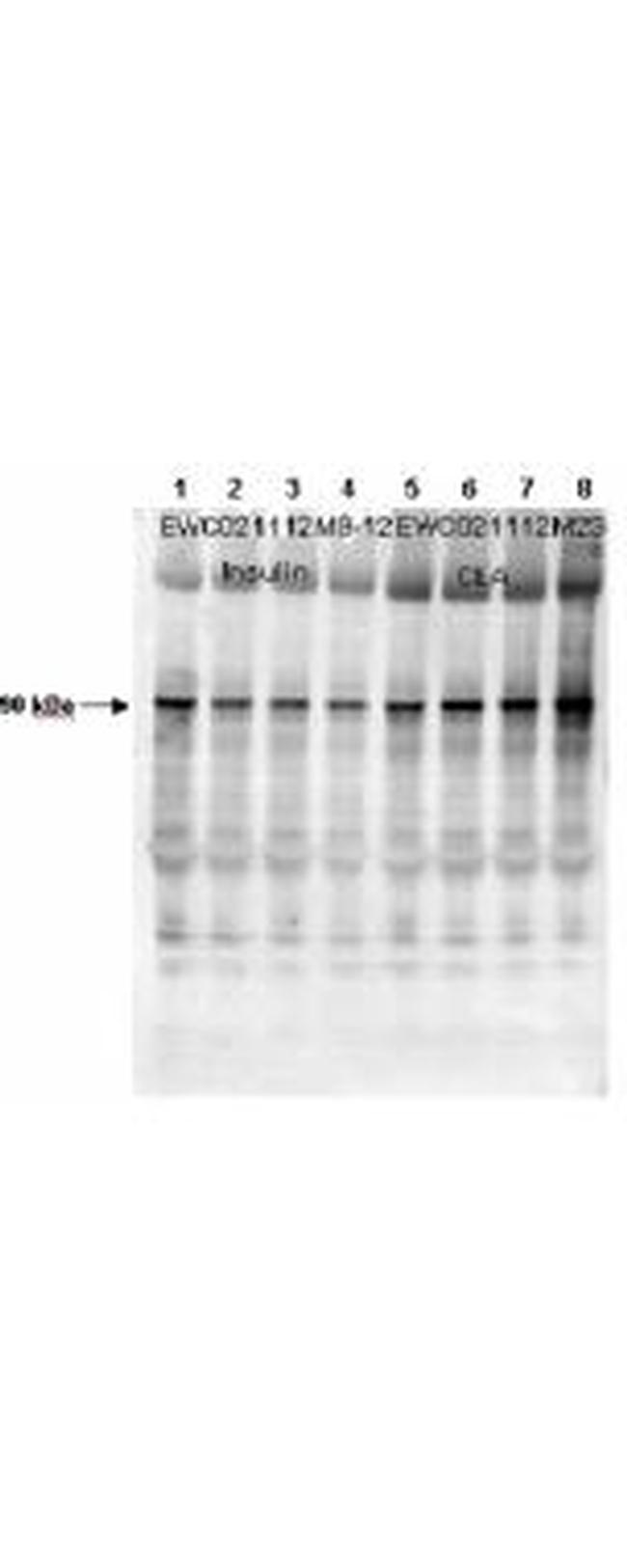 Phospho-GYS1 (Ser640) Antibody in Western Blot (WB)