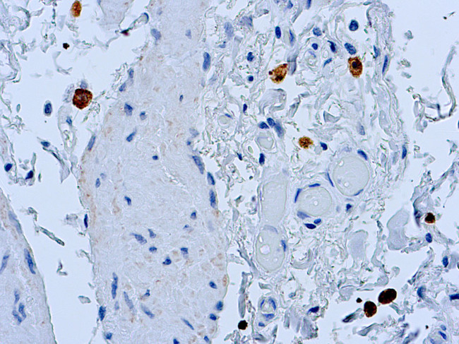 Caspase 8 Antibody in Immunohistochemistry (Paraffin) (IHC (P))