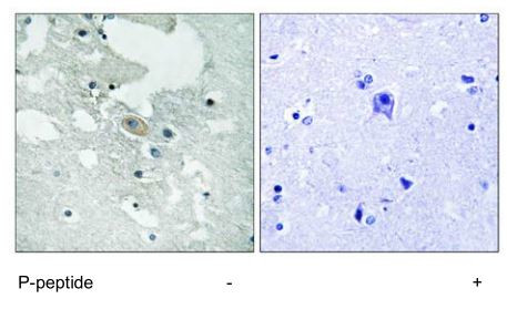 Phospho-BLNK (Tyr84) Antibody in Immunohistochemistry (Paraffin) (IHC (P))