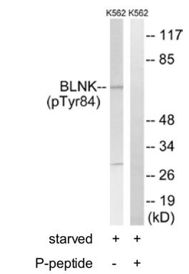 Phospho-BLNK (Tyr84) Antibody in Western Blot (WB)