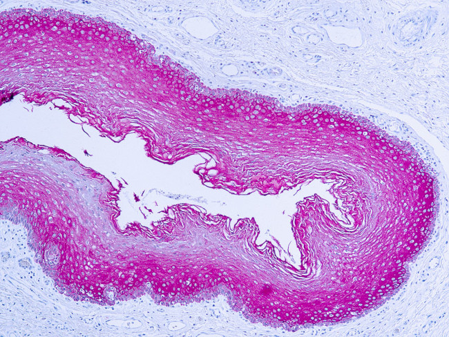 Cytokeratin Pan Antibody in Immunohistochemistry (Paraffin) (IHC (P))