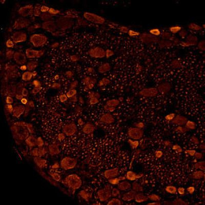 P2X3 Antibody in Immunohistochemistry (IHC)