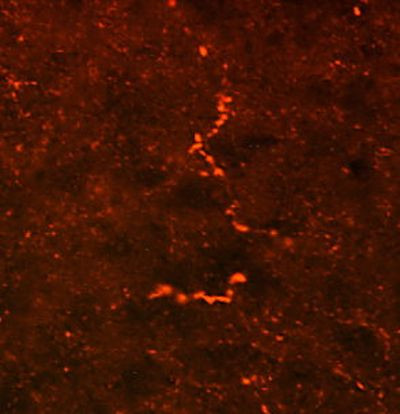 Prodynorphin Antibody in Immunohistochemistry (IHC)