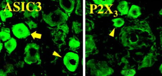 ASIC3 Antibody in Immunohistochemistry (IHC)