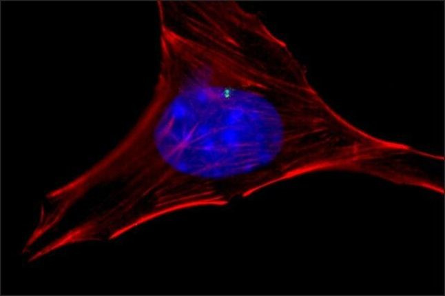 gamma Tubulin Antibody in Immunocytochemistry (ICC/IF)