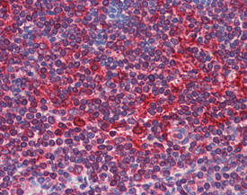 TAP1 Antibody in Immunohistochemistry (IHC)