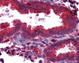 TAP1 Antibody in Immunohistochemistry (IHC)