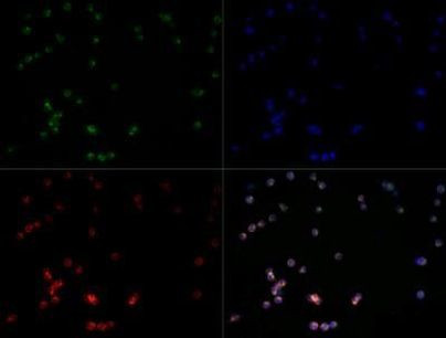 TLR7 Antibody in Immunocytochemistry (ICC/IF)