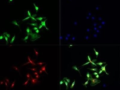 TLR7 Antibody in Immunocytochemistry (ICC/IF)