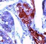 NSE Antibody in Immunohistochemistry (Paraffin) (IHC (P))