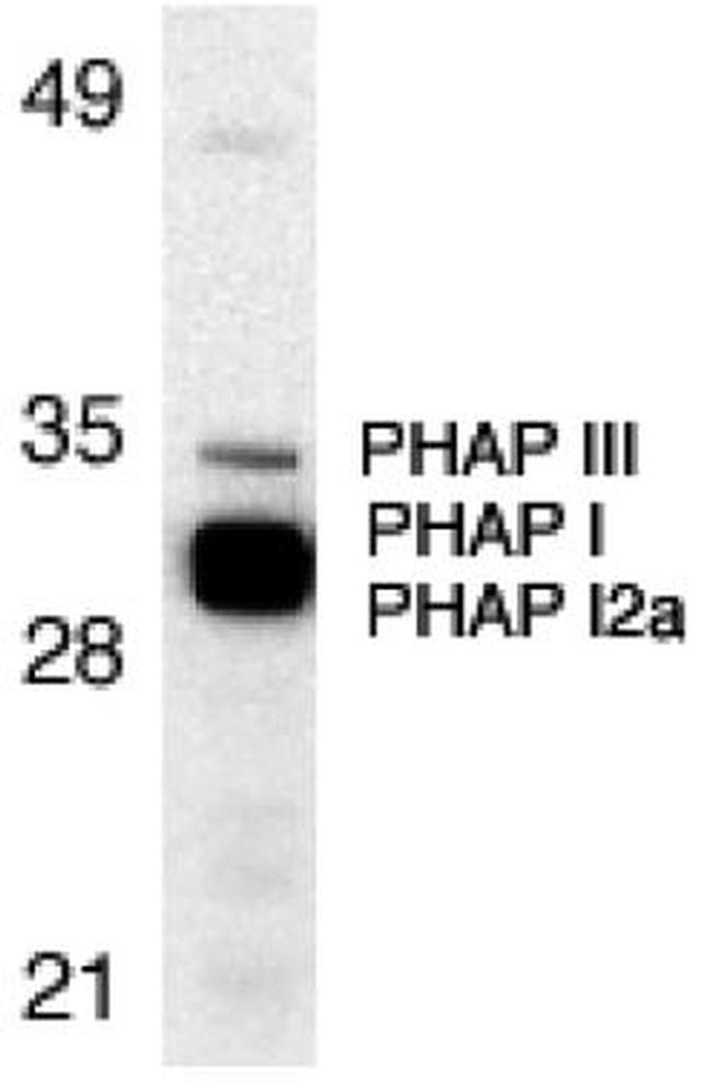 PHAP Antibody in Western Blot (WB)