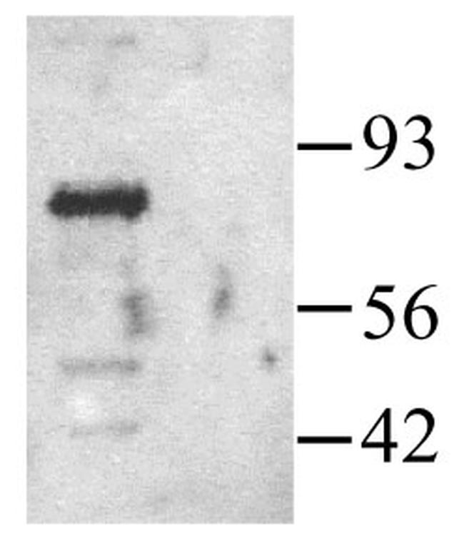 PAK1 Antibody in Western Blot (WB)