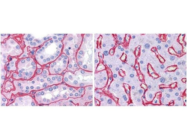 Collagen IV Antibody in Immunohistochemistry (Paraffin) (IHC (P))