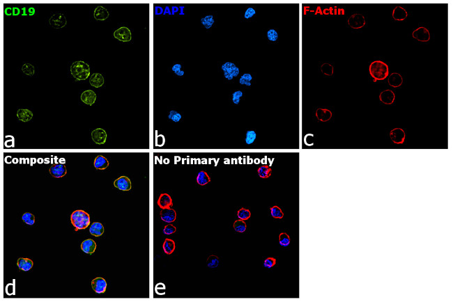 Rat IgG (H+L) Secondary Antibody in Immunocytochemistry (ICC/IF)