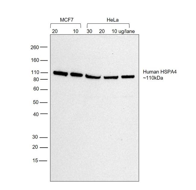 Human IgG (H+L) Secondary Antibody in Western Blot (WB)