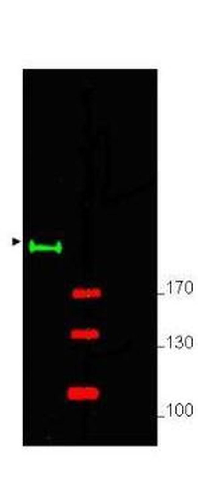 GLI2 Antibody in Western Blot (WB)