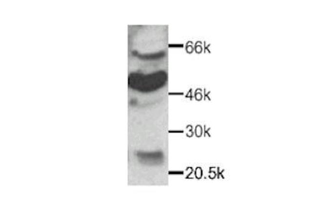 CX3CR1 Antibody in Western Blot (WB)